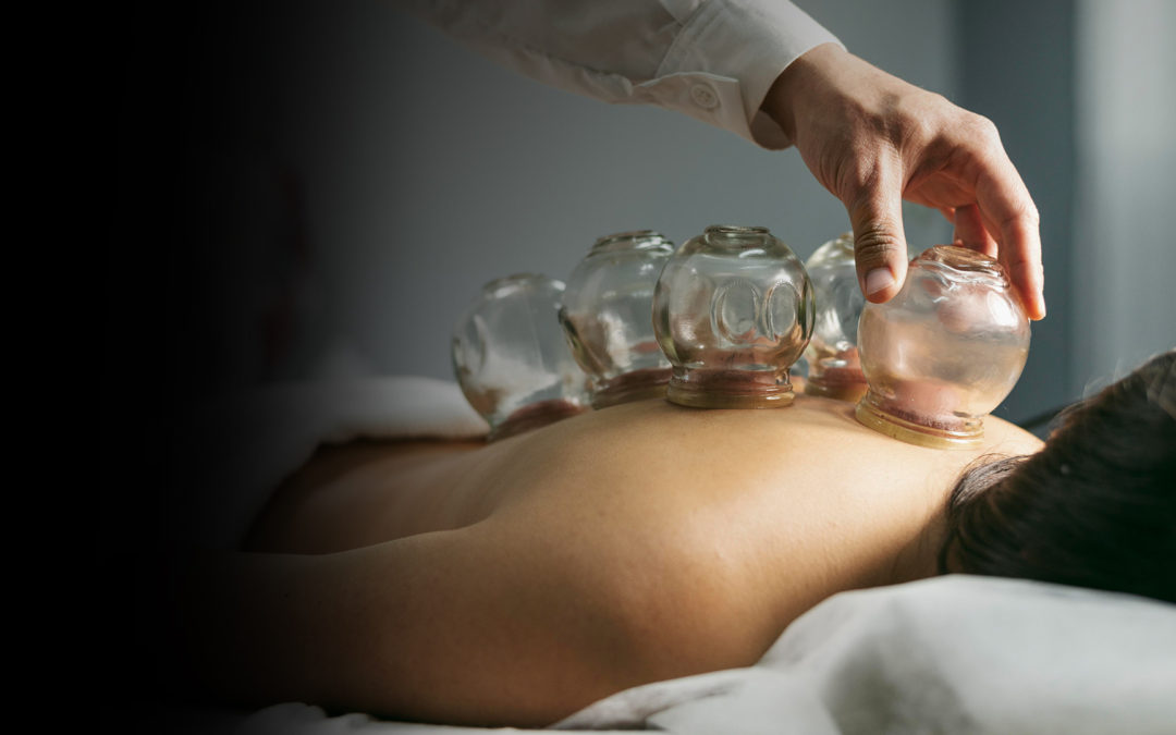 Cupping Massage Services